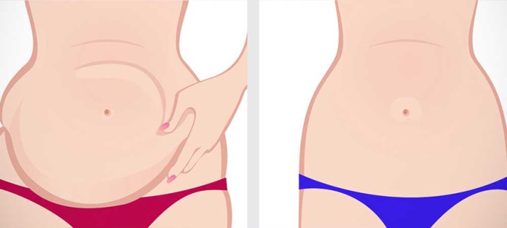 Dicas de Como Eliminar a Gordura Abdominal