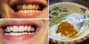 Remédios Caseiros Para Tratar Dentes Amarelos