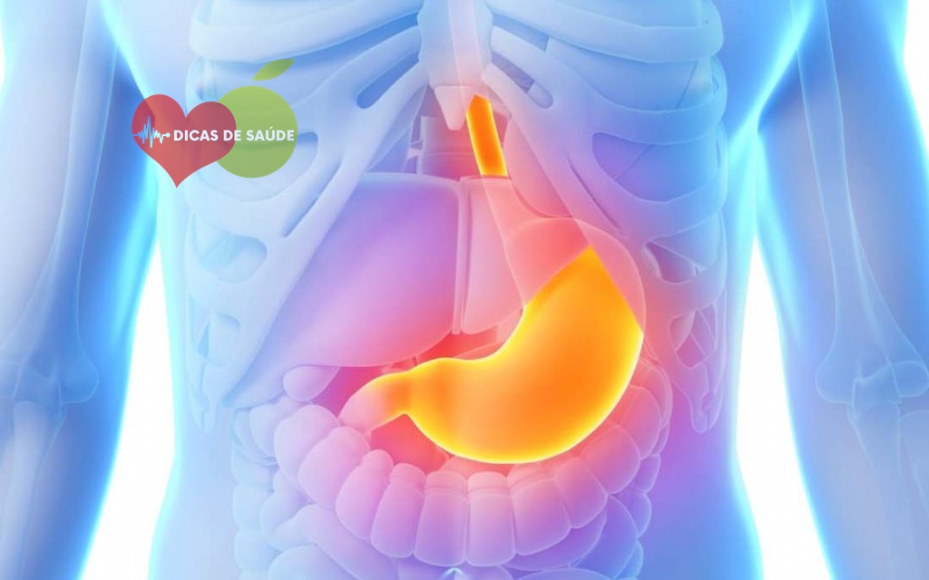 remédios naturais para tratar refluxo e ulcera