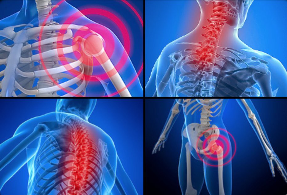 Sintomas da Fibromialgia