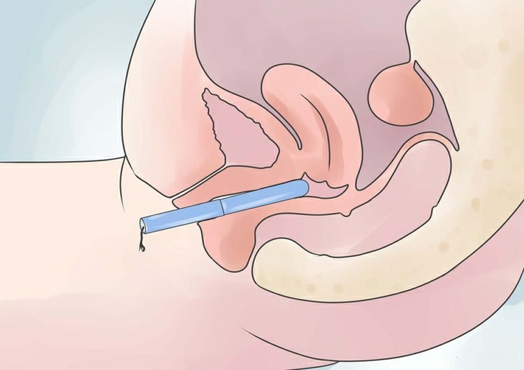 Como Inserir um Absorvente Interno Pela Primeira Vez 