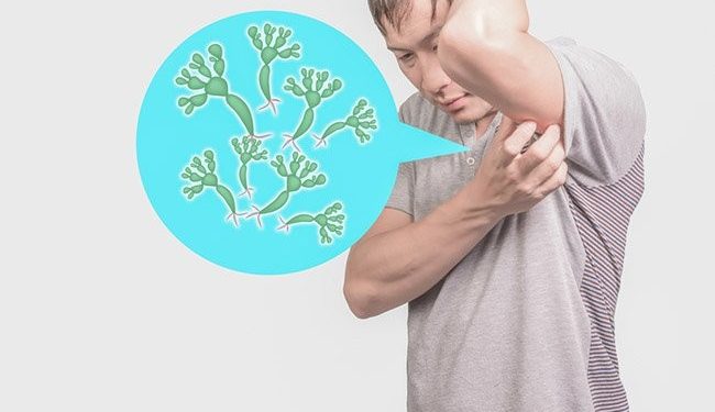 As 4 Dicas Caseiras Para Eliminar os Fungos nas Axilas