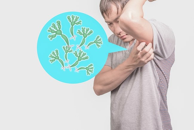 Eliminar os Fungos nas Axilas Eliminar os Fungos nas Axilas