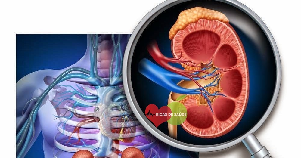 Sinais de Problema nos Rins que Muitos Ignoram