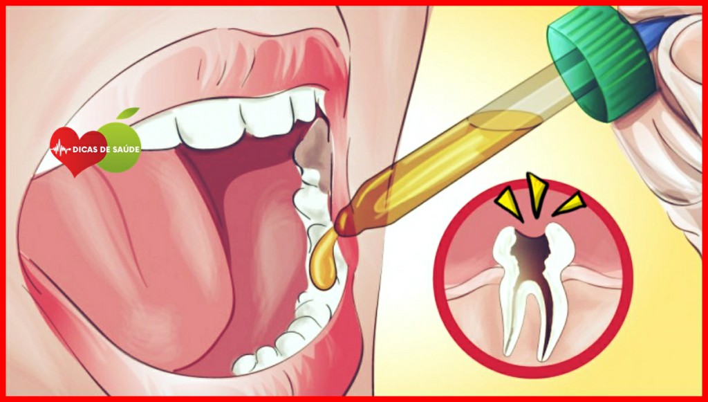 Tratar a Dor de Dente Naturalmente