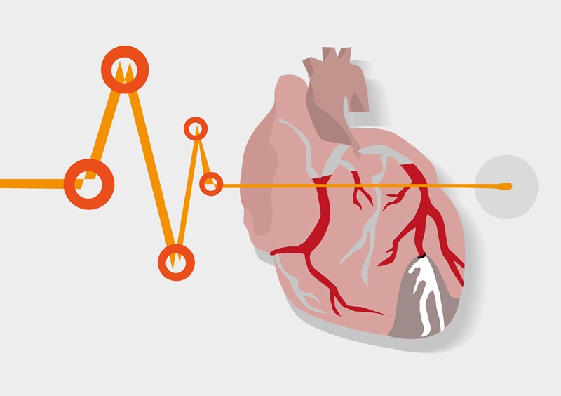 Angina Pectoris - O que é, Sintomas e Tratamentos!