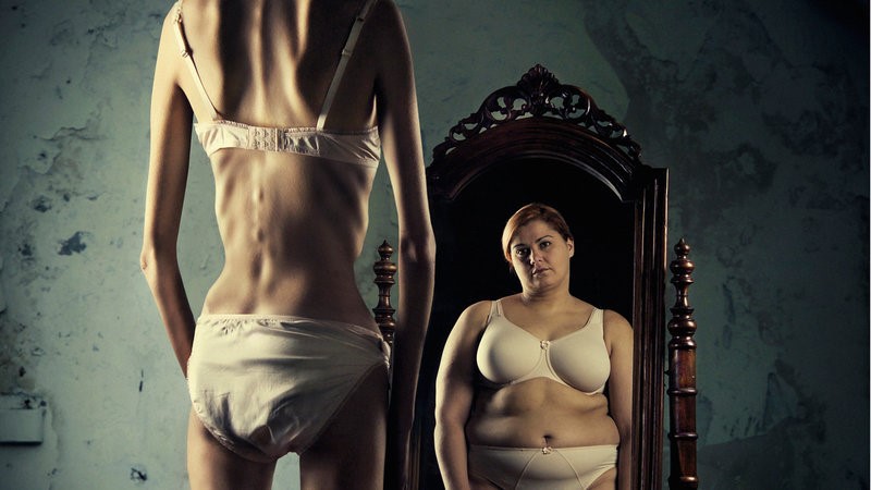 Anorexia Nervosa