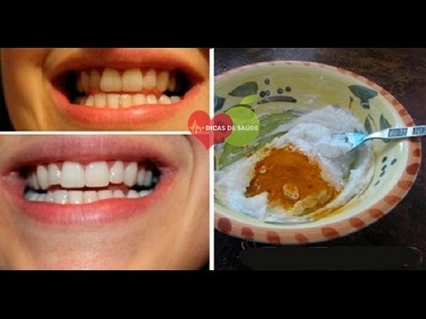 Como Clarear os Dentes em 3 Minutos Naturalmente