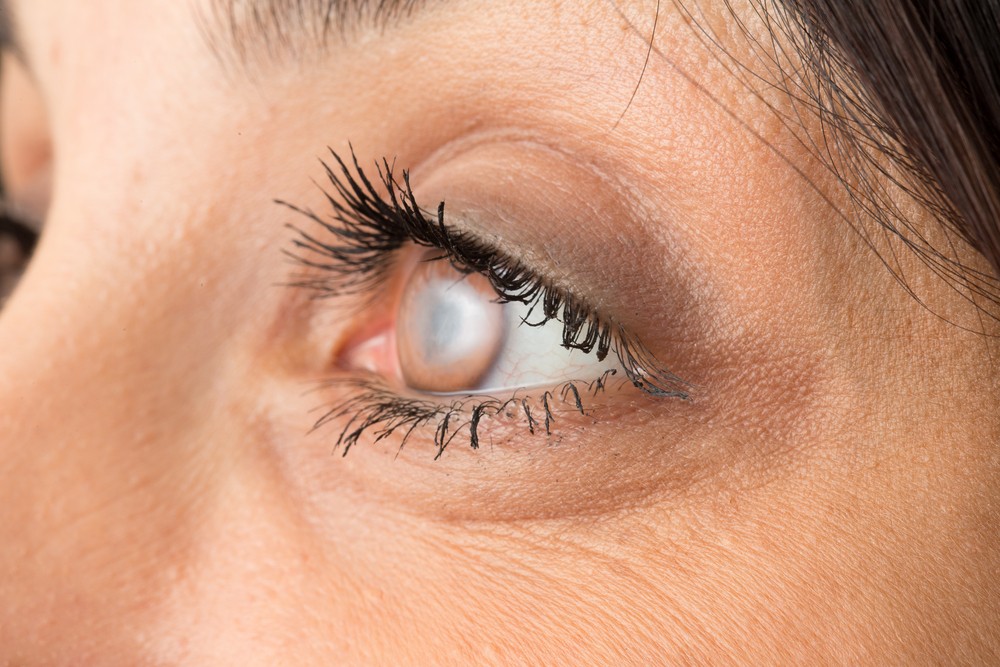 Doenças Comuns que Podem Atingir os Olhos