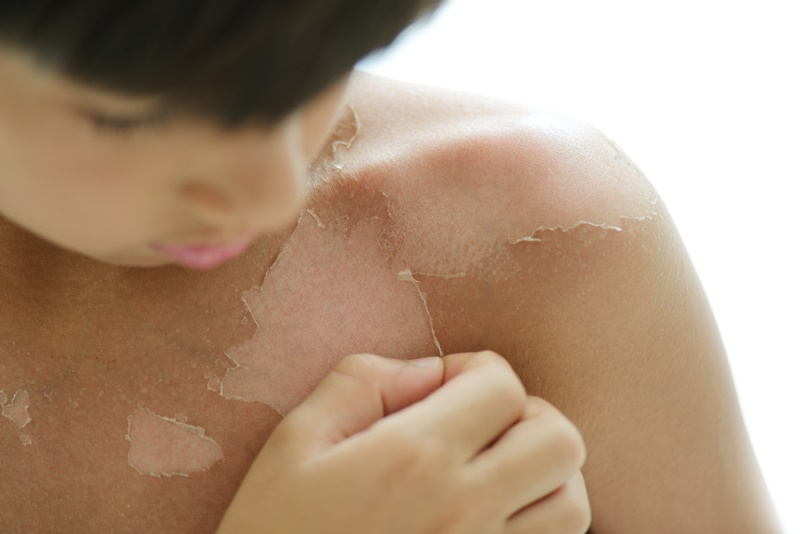Doenças de pele mais comuns-1