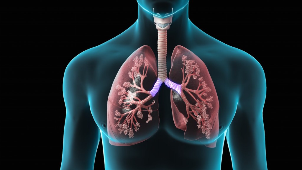 Fibrose Pulmonar