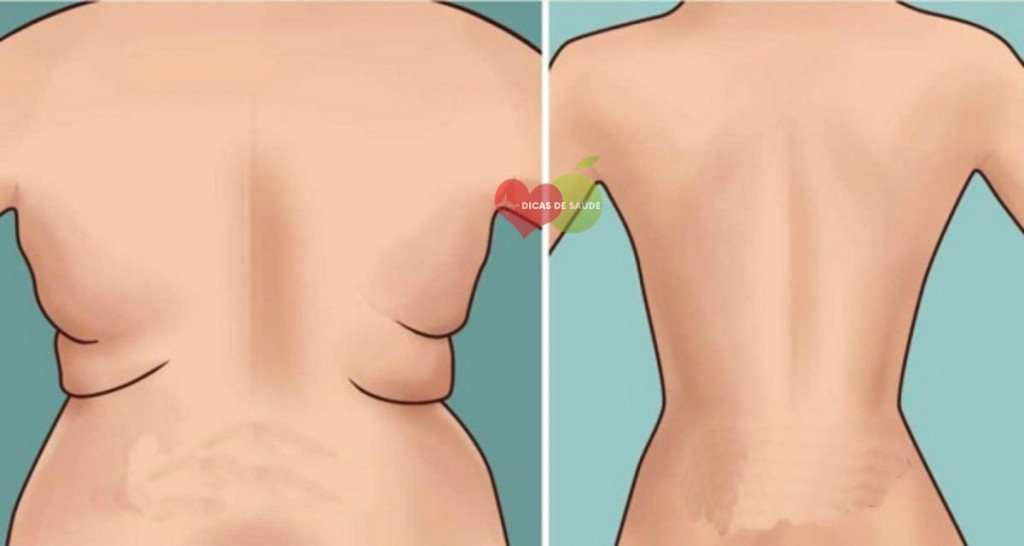 Maneiras de Eliminar o Culote em Casa 4