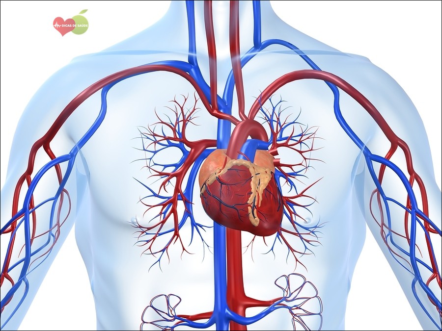 Miocardiopatia Dilatada-Miocardiopatia Dilatada