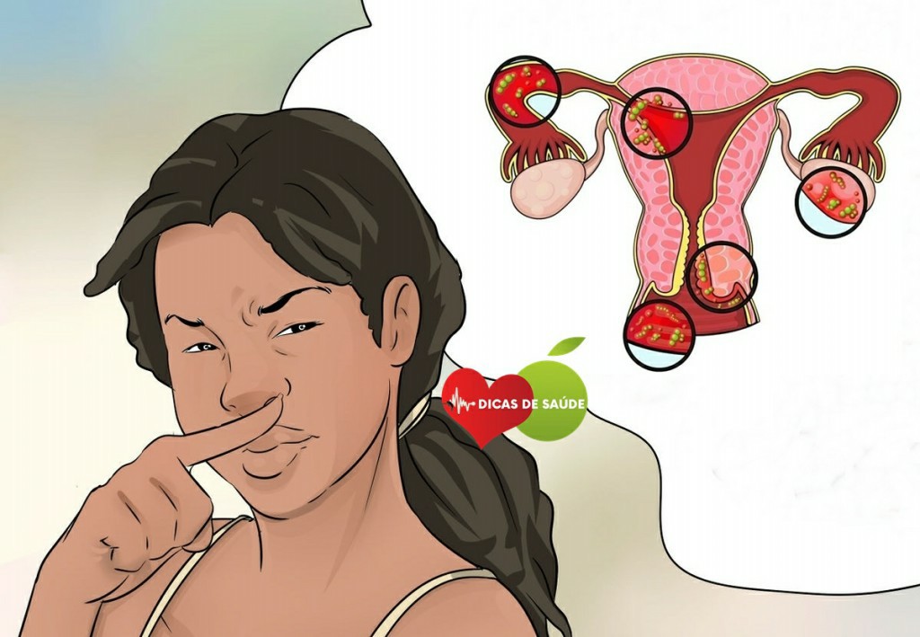 Odor Vaginal