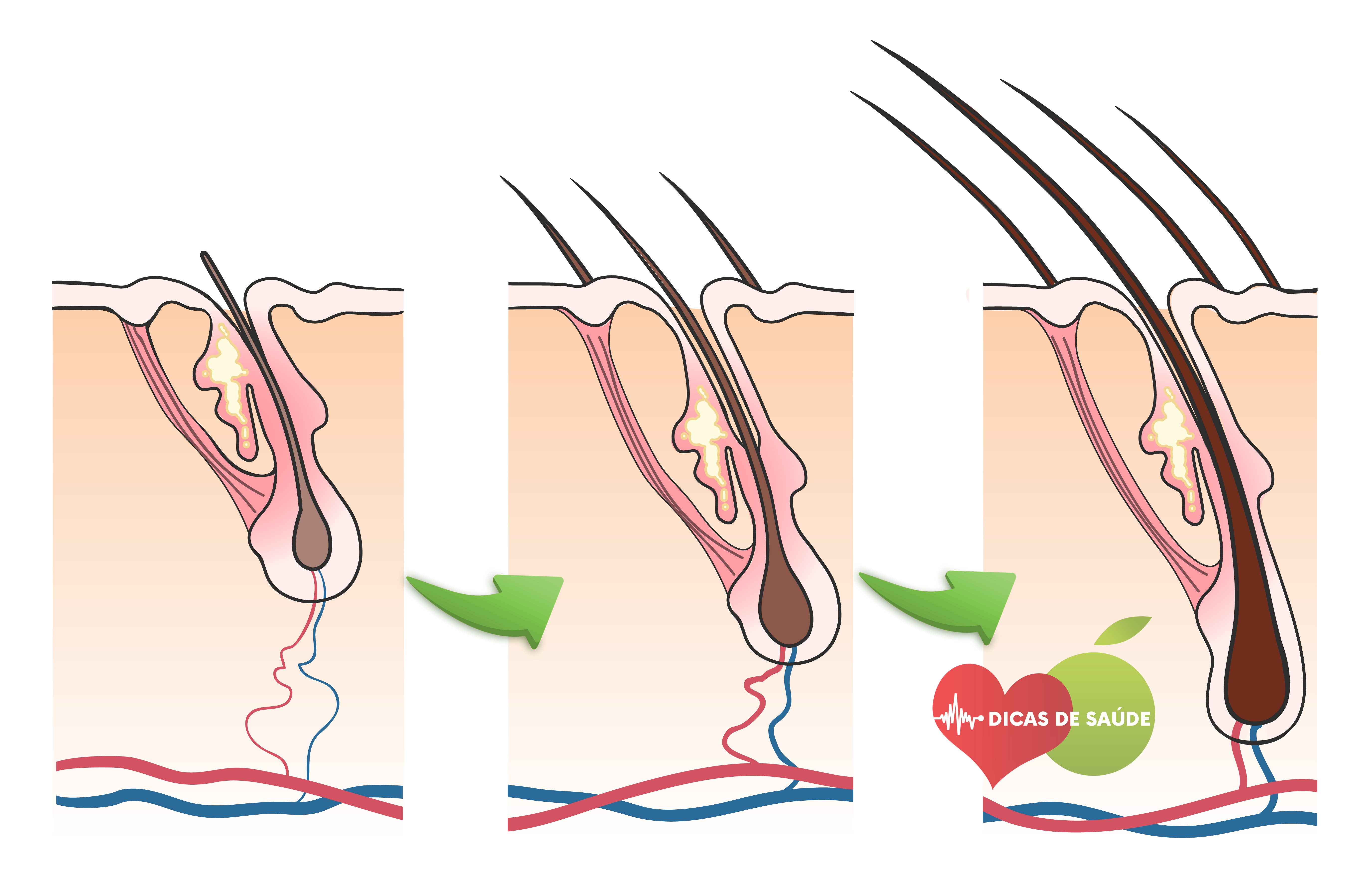 Como Evitar a Queda de Cabelo