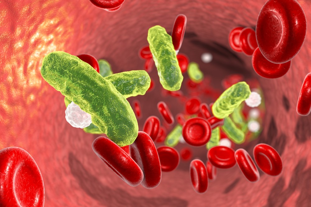 Septicemia Causas Sintomas e Tratamentos