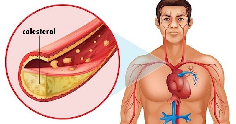 Remédio Caseiro Para Diminuir o Colesterol Naturalmente!