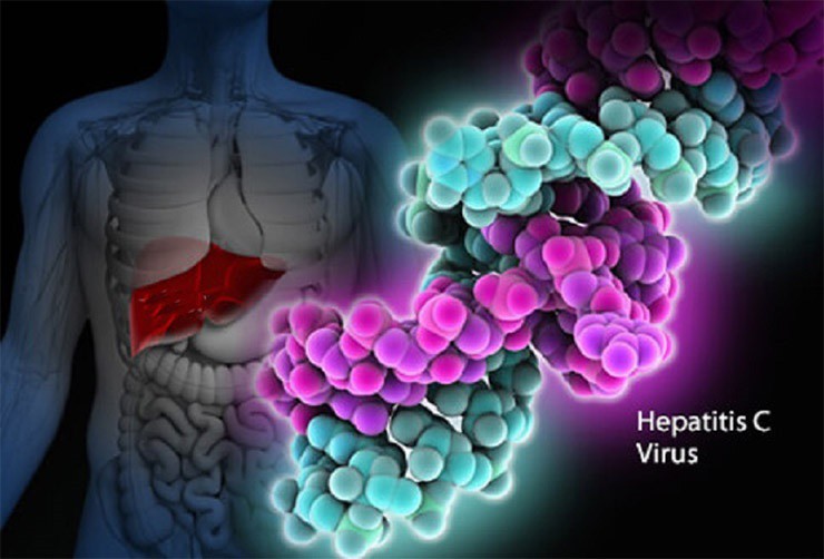 Hepatite C - Sintomas, Causas e Tratamentos