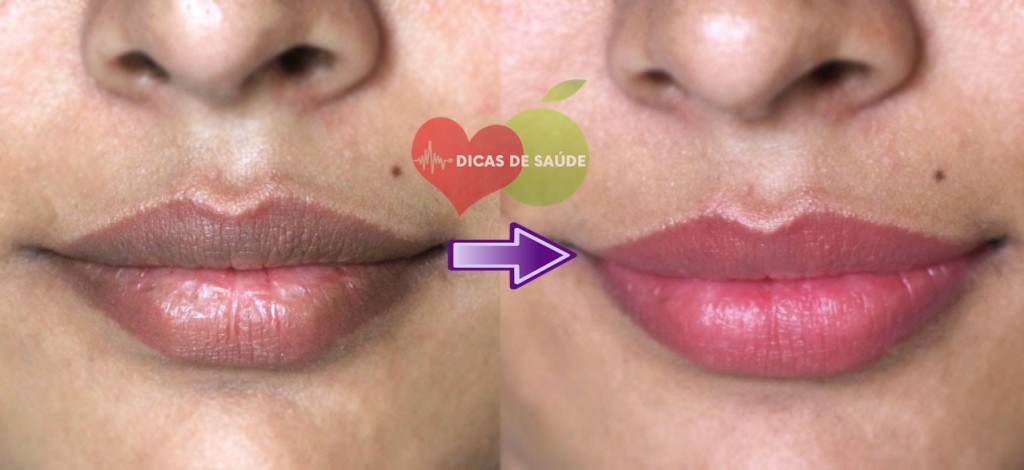 labios rosados