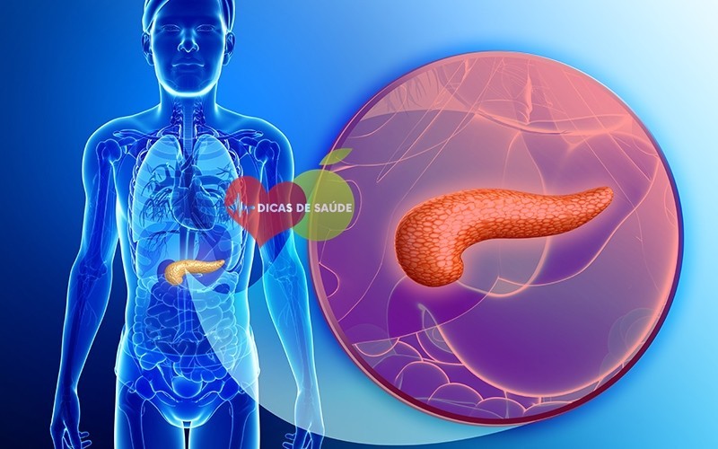 pancreatite cronica