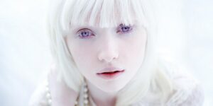 Tipos de Albinismo