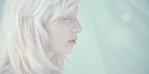 Albinismo 6