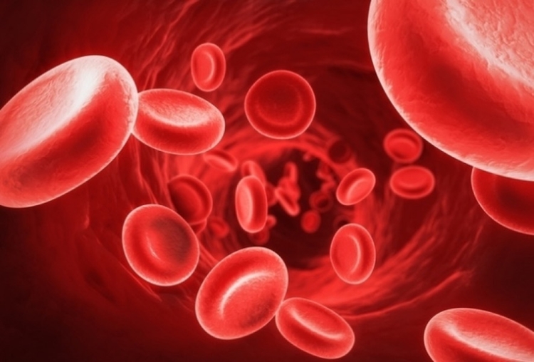 Anemia Megaloblástica