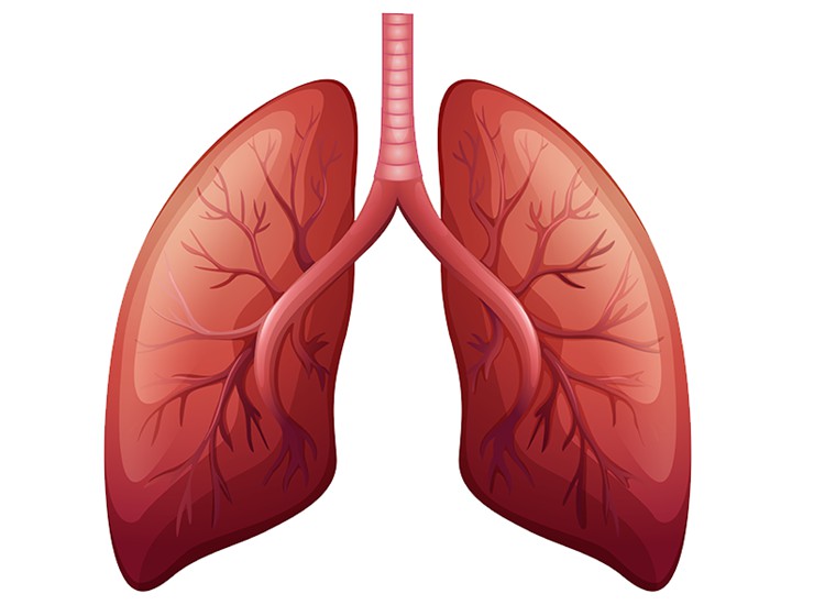 Sintomas do Bronquiectasia