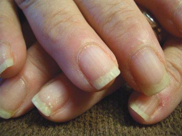 dicas para Fortalecer as Unhas