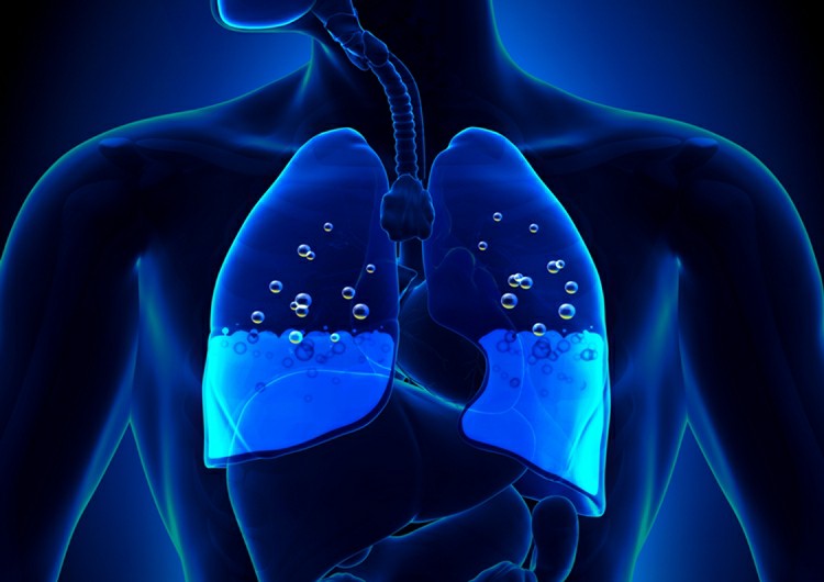 edema pulmonar 1 1
