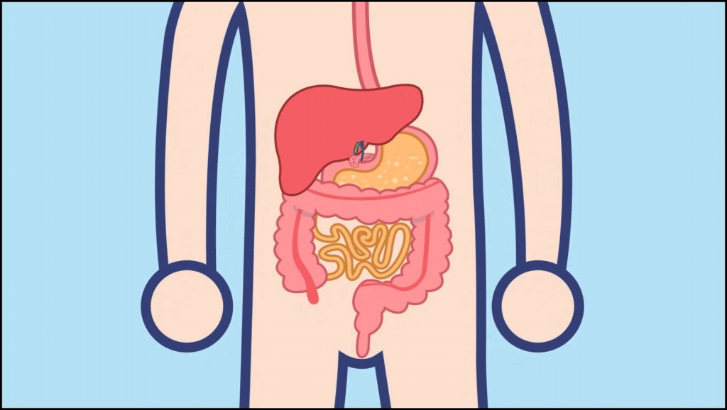 Síndrome do Intestino Curto