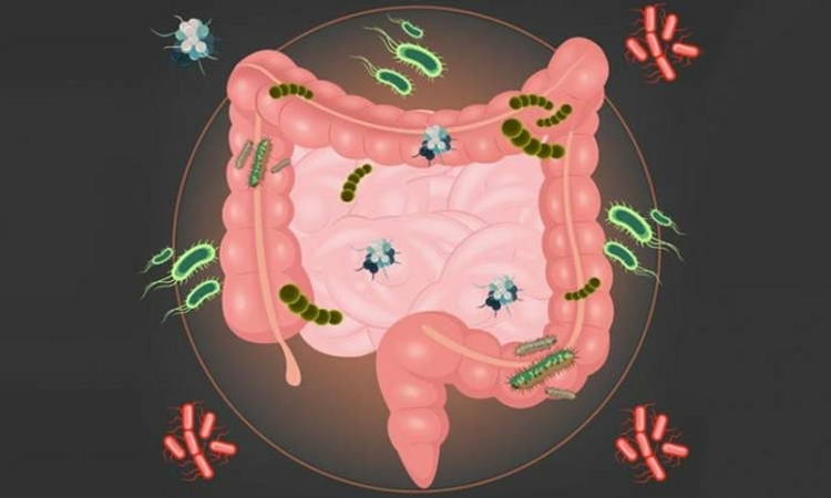 Criptosporidíase