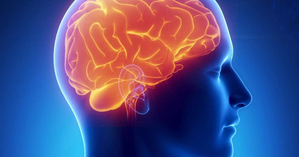 Hemorragia Intracerebral