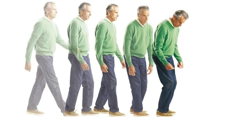 Principais Sintomas da Doença de Parkinson