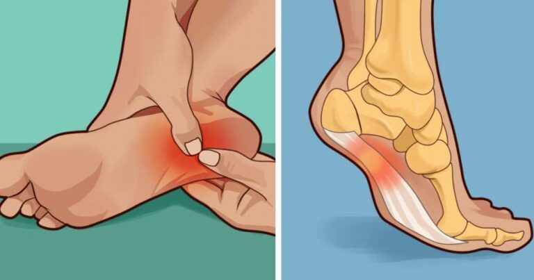 As 10 Dicas Para Aliviar a dor no Calcanhar Naturalmente Dicas de Saúde