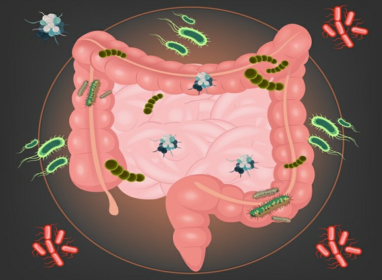 gastroenterite