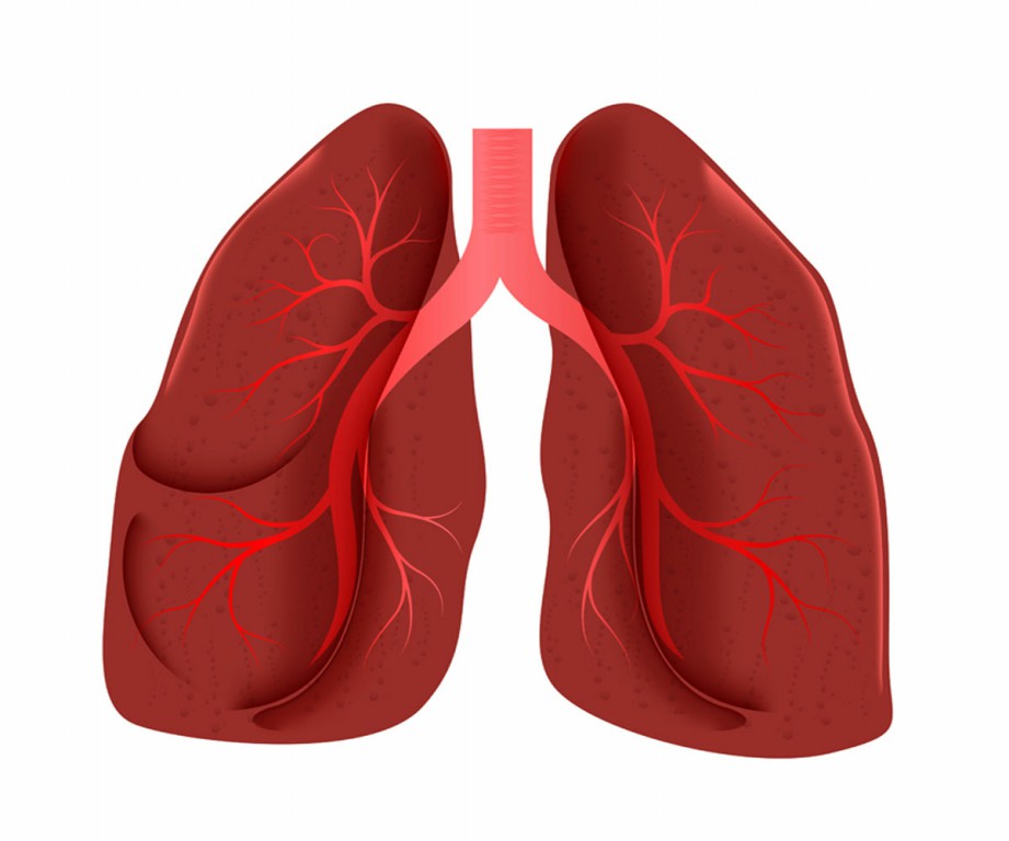 Síndrome de Dificuldade Respiratória Aguda