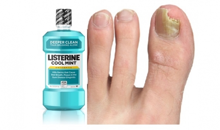 Formas de Usar Listerine