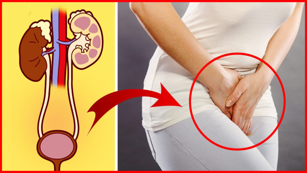 3 receitas caseiras para aliviar a dor de urina Dicas de Saúde 3 receitas caseiras para aliviar a dor de urina Dicas de Saúde