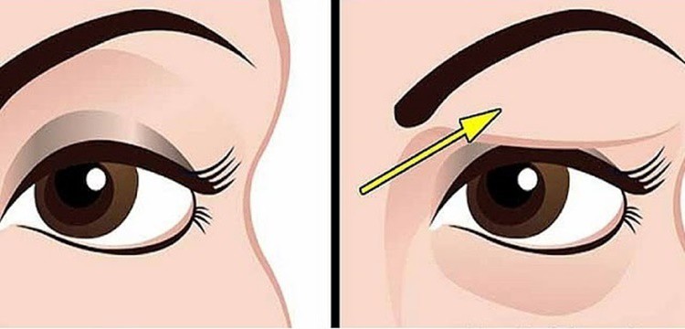 dicas-caseiras-para-acabar-com-olhos-inchados