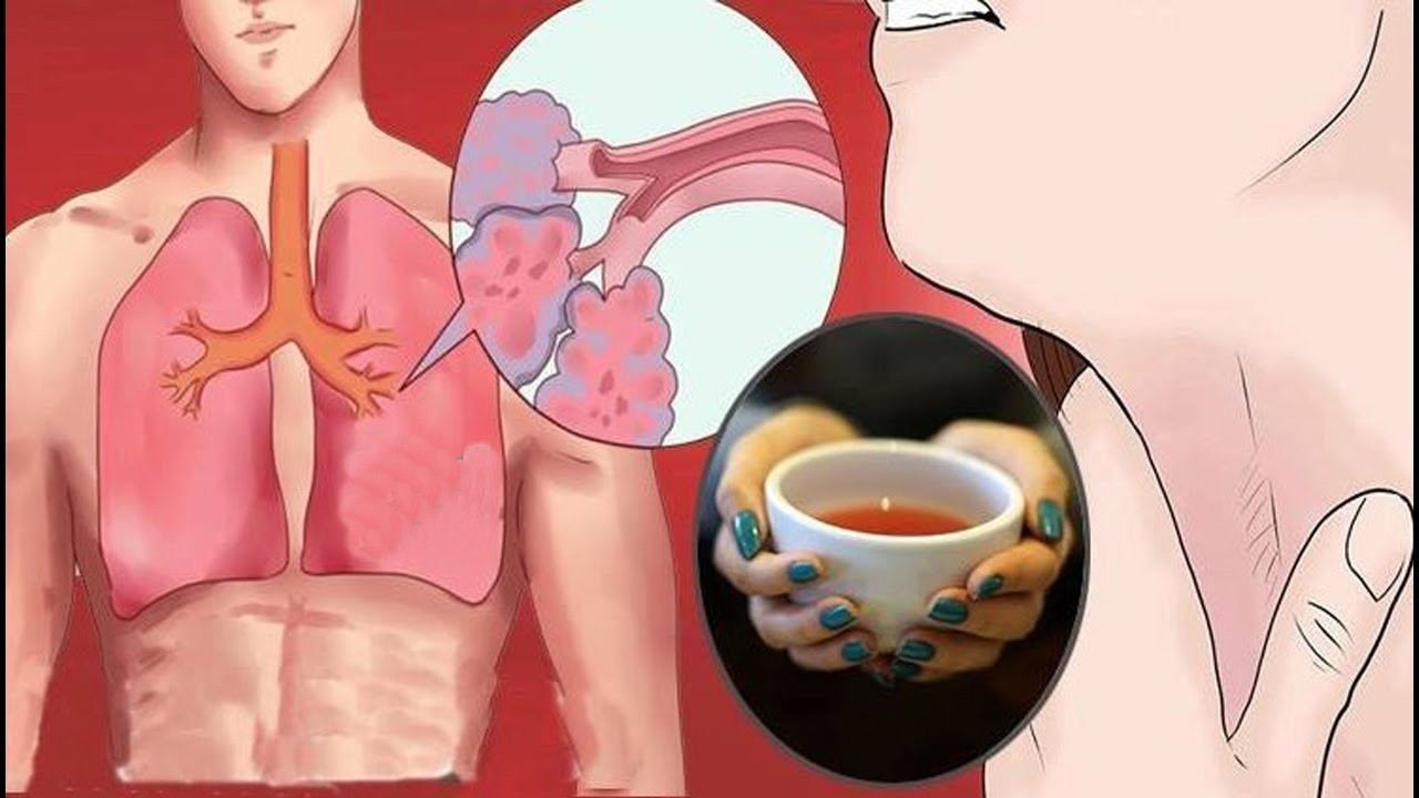 remedios caseiros para curar a tosse em casa