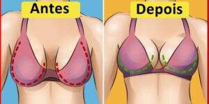 Como Evitar a Flacidez e Queda dos Seios
