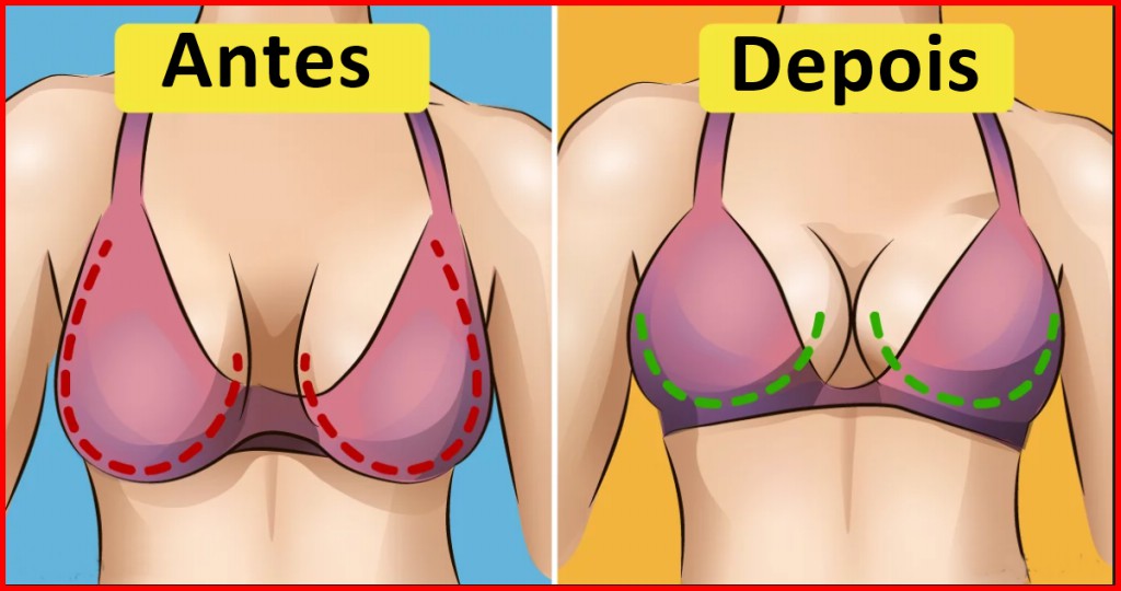 Como Evitar a Flacidez e Queda dos Seios