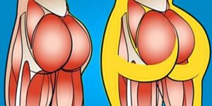 exercícios para queimar gordura do bumbum