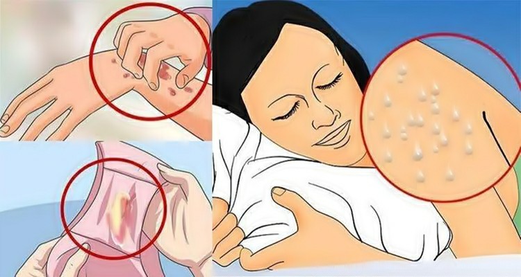 sintomas do HIV