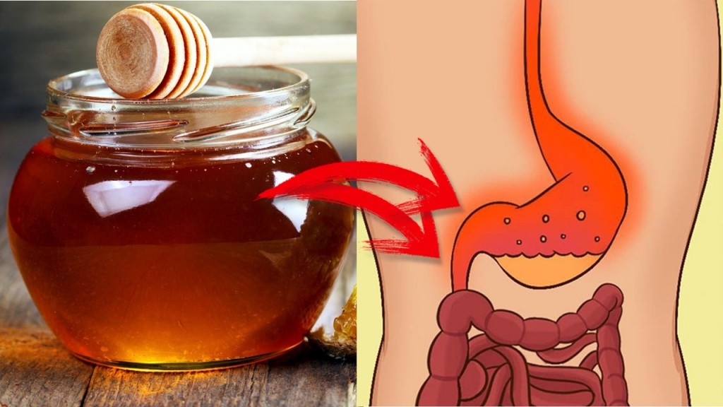 como curar o refluxo acido usando mel