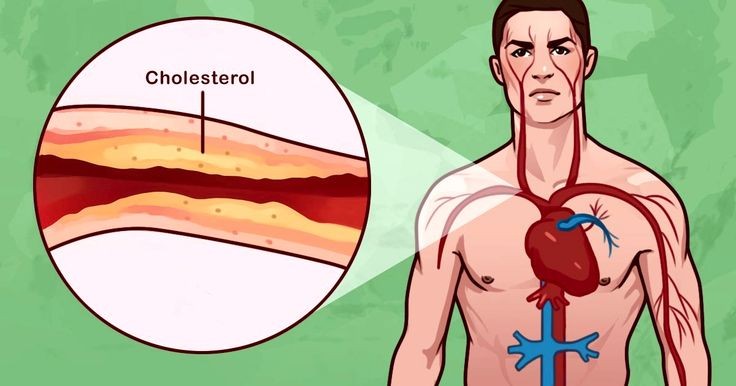 como reduzir o colesterol