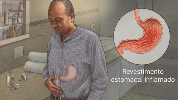 Dieta para tratar a gastrite: alimentos, cardápio e benefícios