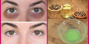 formas de usar o oleo de ricino para eliminar olheiras