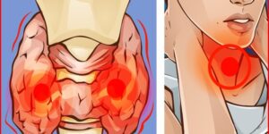 sintomas que indicam problemas na tireoide